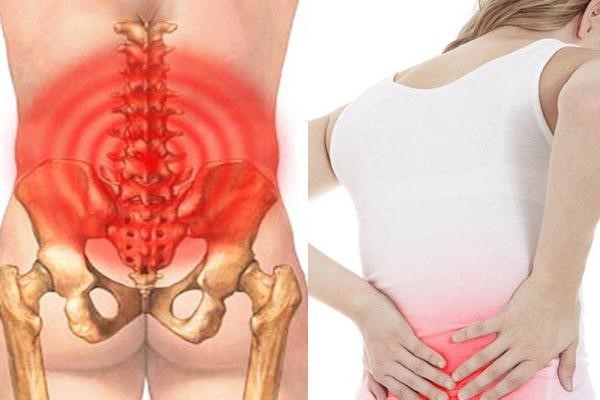 Biện pháp điều trị hiệu quả tình trạng đau thắt lưng